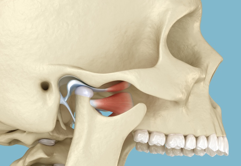 3D Illustration showcasing Temporomandibular Joints Dislocation in Castle Rock, CO